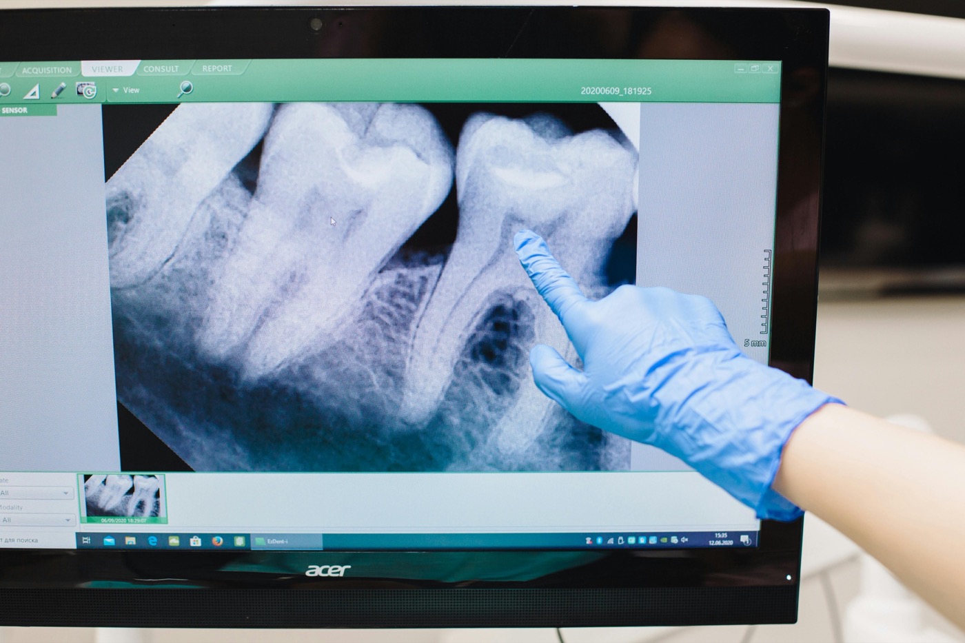 Radiografía dental revisada durante diagnóstico