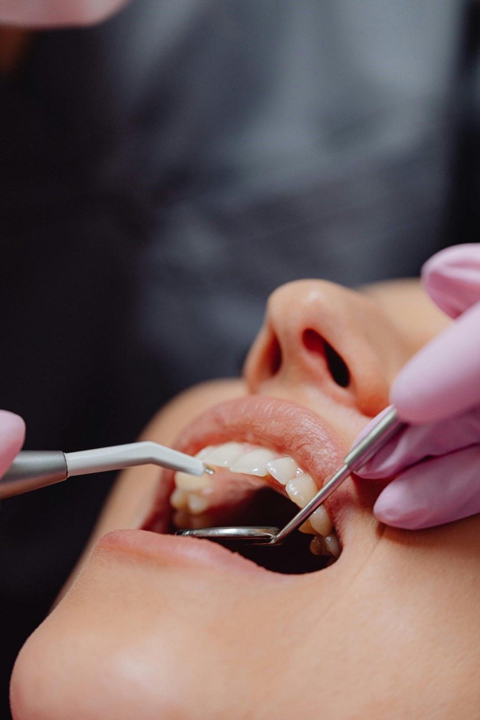 Profilaxis dental durante atención clínica